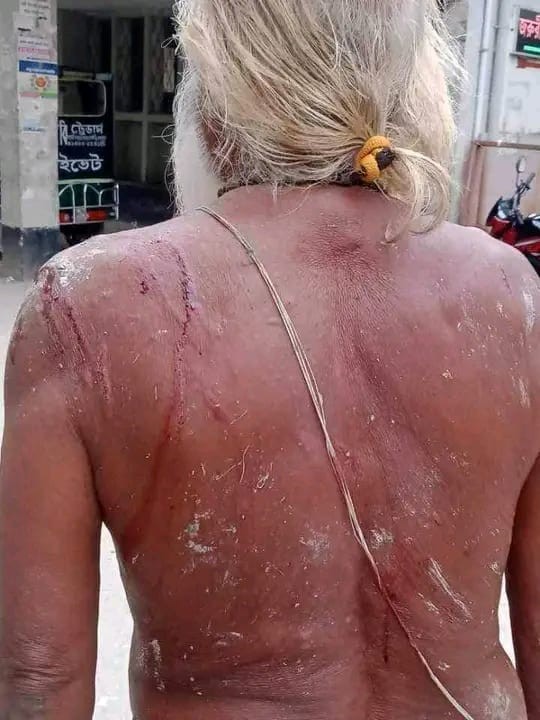 কুড়িগ্রাম জেলার নাগেশ্বরী উপজেলার বন্দ ইউনিয়নে পল্লীকবি শ্রী রাধাকান্ত দাস এর উপর অতর্কিত হামলা চালায় দুর্বৃত্তরা ...!