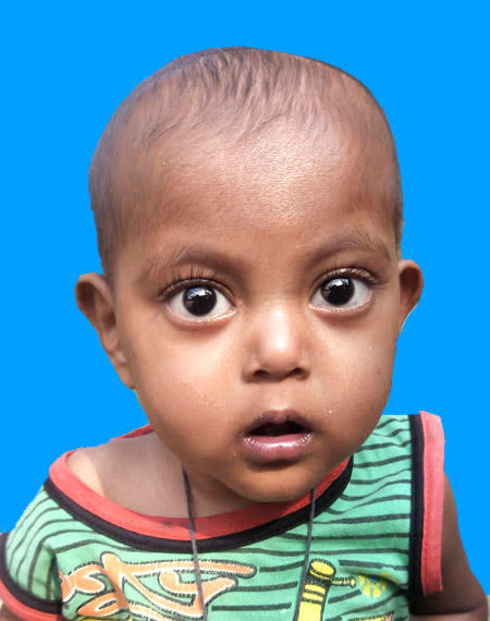 একটি মানবিক সাহায্যের আবেদন- ইয়ামিন বাঁচাতে সাহায্য করুন
