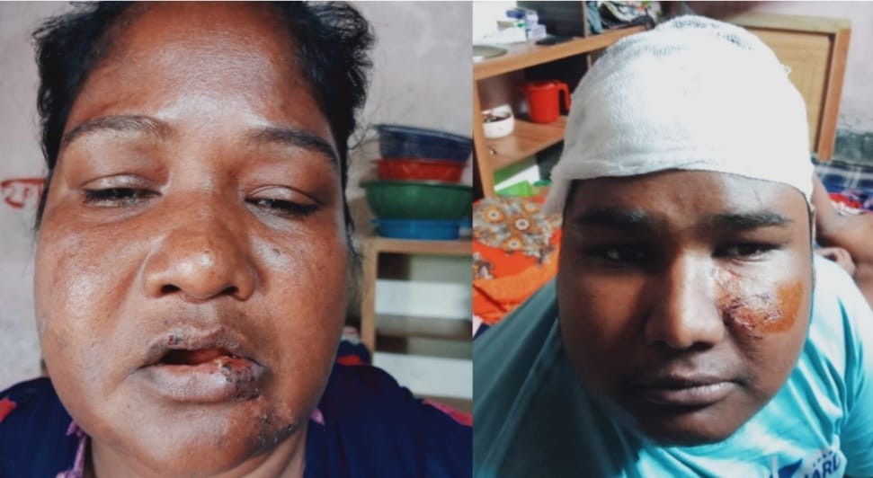 পারিবারিক কলহে সহোদর ভাই-বোনদের হামলায় মা-ছেলেসহ আহত-২