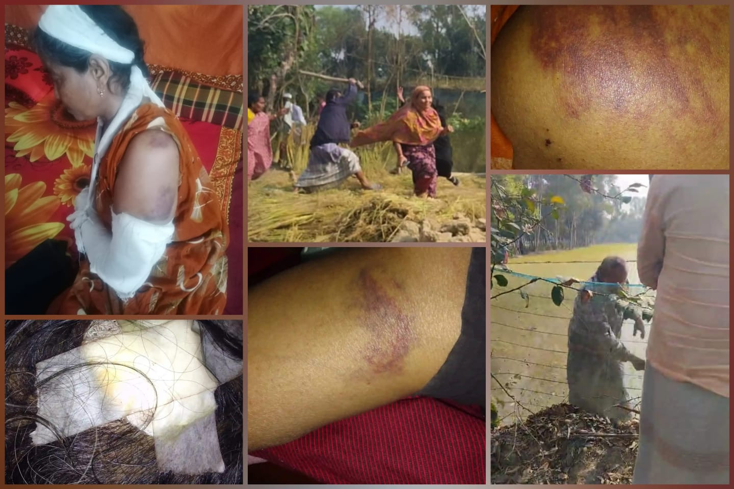 মুক্তাগাছায় ভূমিদস্যুদের হামলায় হামলায় গুরুতর আহত -২ থানায় মামলা
